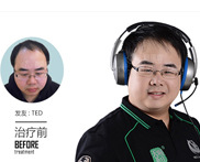 六味地黄丸治疗哪种脱发有效