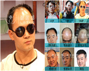 成都哪里做眉毛好