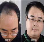 养血生发胶囊,养血生发胶囊价格,养血生发胶囊