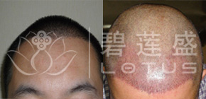 碧莲盛客户:Jackson