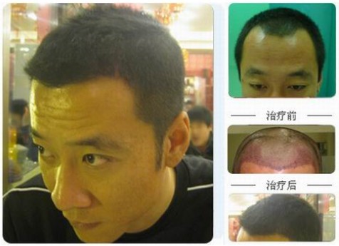 碧莲盛客户.jpg