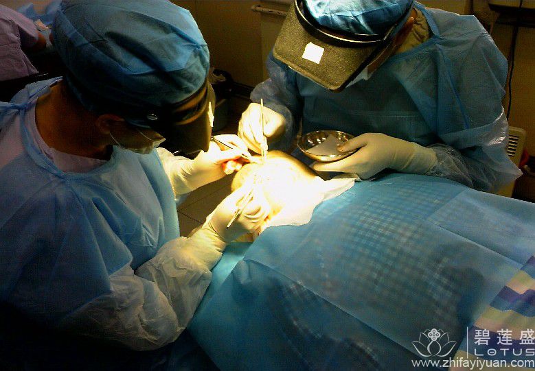 种发手术会失败吗 种发手术成功率是多少 - 碧
