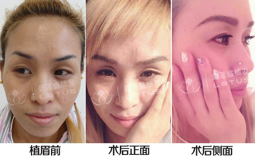 做眉毛前后的比较图片